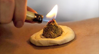 【艾灸知識(shí)】十大常見艾灸不良反應(yīng)，及處理方法！建議收藏！